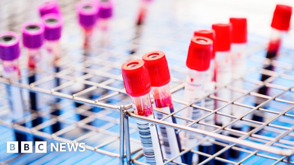 Wissenschaftler sagen, dass sie HIV aus Zellen herausschneiden können