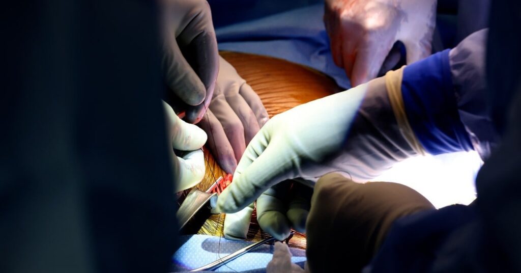 Er bekam eine Schweinenierentransplantation.  Jetzt müssen Ärzte dafür sorgen, dass es funktioniert