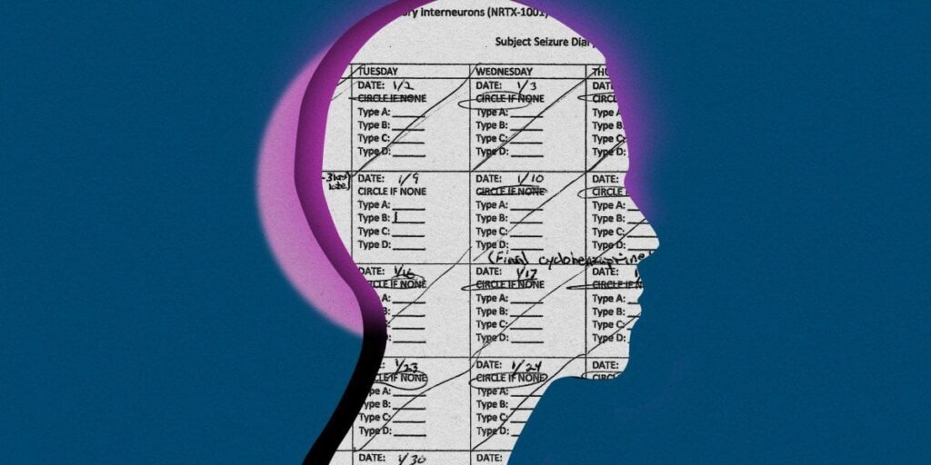 Gehirnzelltransplantationen sind die neueste experimentelle Epilepsiebehandlung