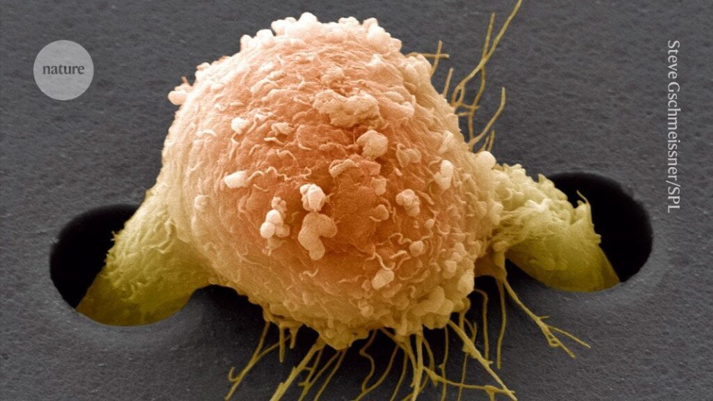 KI verfolgt mysteriöse metastasierende Krebsarten bis zu ihrer Quelle.  Der Algorithmus untersucht Bilder metastatischer Zellen, um den Ort des Primärtumors zu identifizieren.