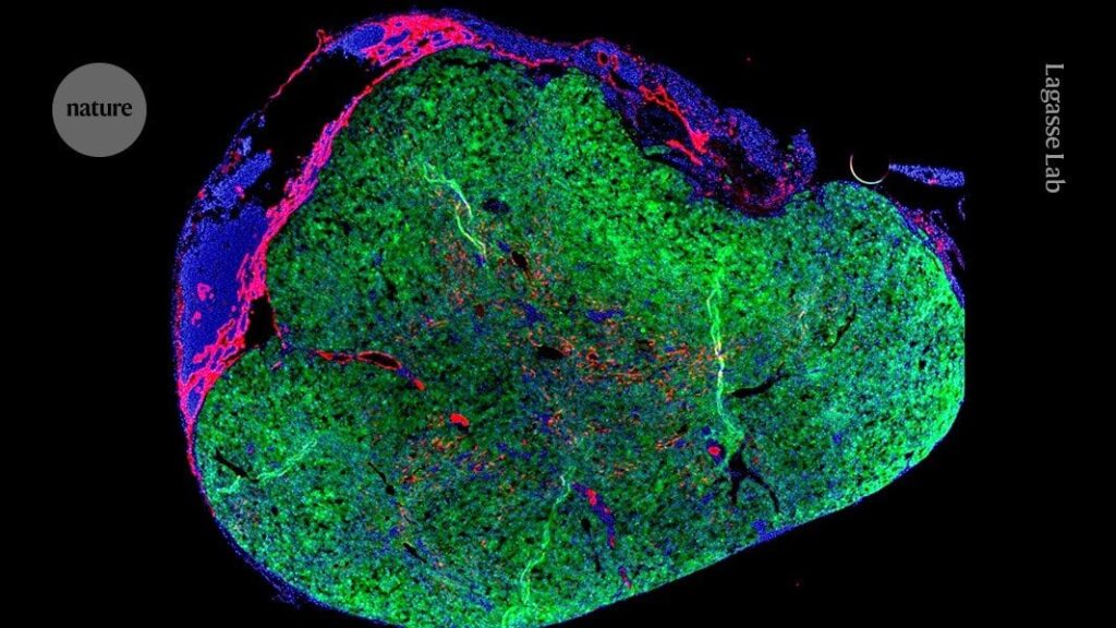 „Mini-Leber“ wird in einem mutigen neuen Versuch im eigenen Lymphknoten einer Person wachsen.  Das Biotechnologieunternehmen LyGenesis hat erstmals einer Person mit Leberversagen Spenderzellen injiziert.