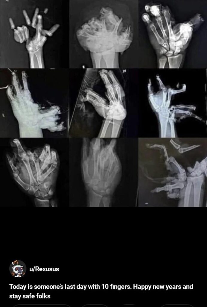 Heute ist der letzte Tag für jemanden mit 10 Fingern.