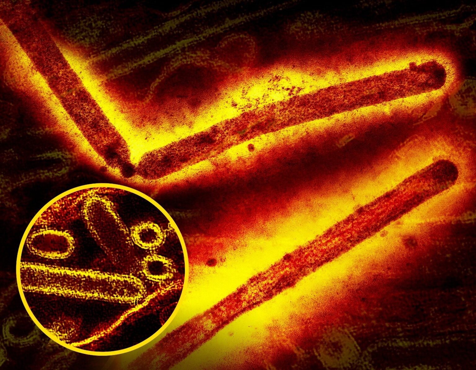 Wissenschaftler entdecken den seltenen Vogelgrippevirus H5N1 bei einem australischen Kind nach einer Reise nach Indien