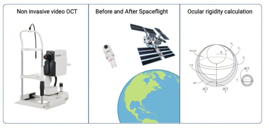 Die Augen der Astronauten schwächen bei langen Raummissionen und wirft Bedenken für Mars -Reisen auf