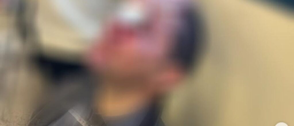 Angriff auf das Gesetz von Athen: "Eine schwangere suspendierte" - real.gr