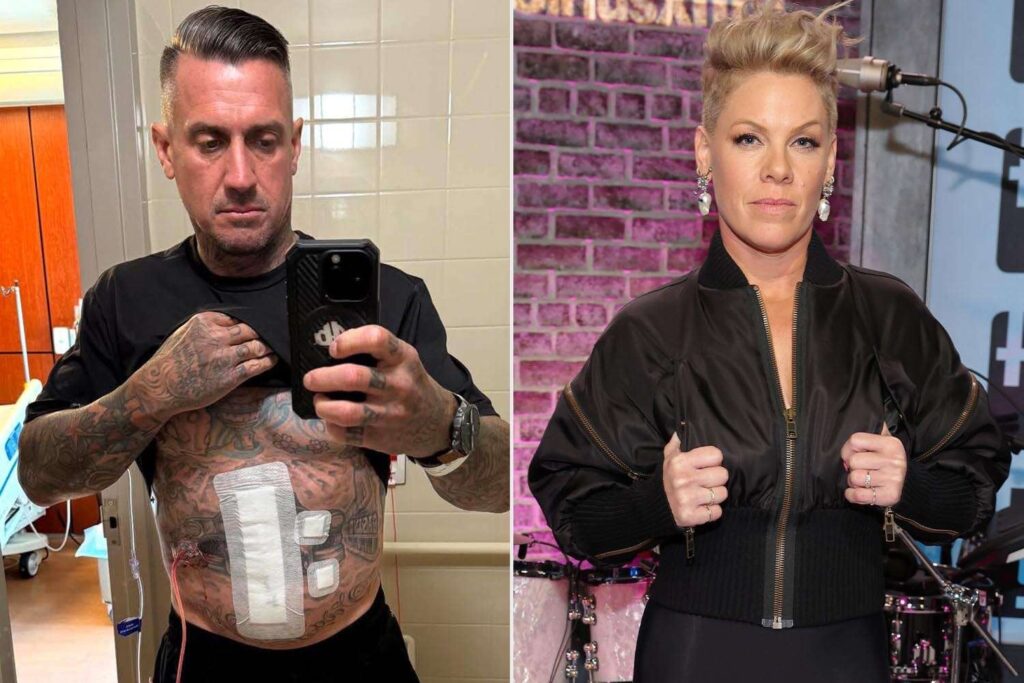 Carey Hart entschuldigt sich bei Frau Pink in der Post, in der brutale Verletzungen enthüllt werden: "Trennte meinen Dünndarm von meinem Dickdarm"