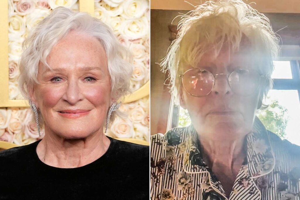 Glenn Close wird real über ihr "Gesicht Fuzz": "Es gehört dazu, menschlich zu sein".