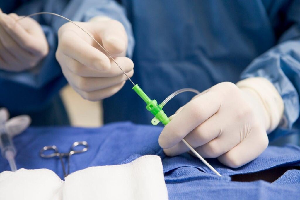 Enthüllt: Frau, die fälschlicherweise einen Teil der Wirbelsäule unter Hunderten von NHS -chirurgischen Fehlern entfernt hatte