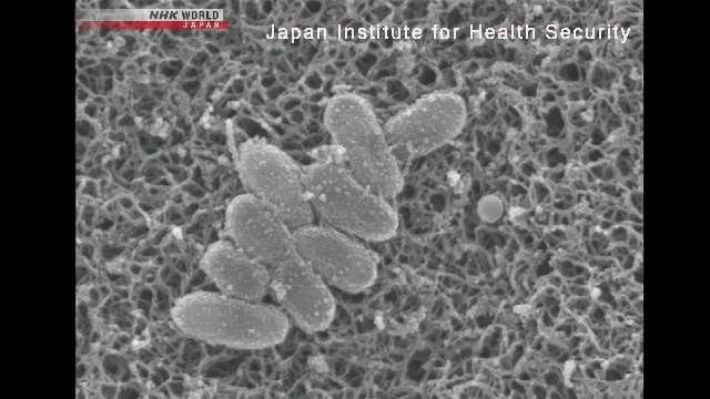 Keuchenhustenkoffer in Japan haben für die 4. Woche in Folge neue Hoch geschlagen