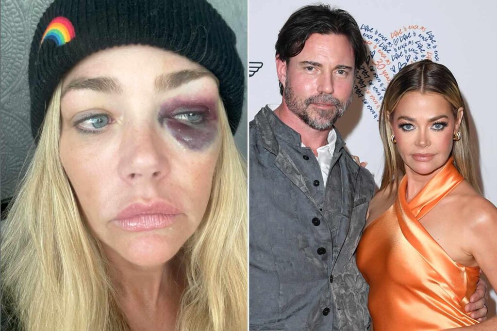 Denise Richards beschuldigt den entfremdeten Ehemann Aaron Phypers häuslicher Gewalt, der vorübergehende Einstiegsordnung erteilt hat