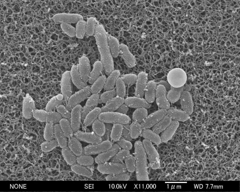 Japan -Keuchhustenfälle erreichten Rekord über 50.000