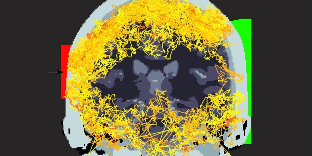 Wissenschaftler scheinen einen Laser durch einen menschlichen Kopf