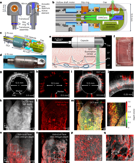 Geknüpfte optoakustische und optische Kohärenztomographie-Kapsel-Endoskopie zur Bewertung der markierungsfreien Bewertung der Barrett-Ösophagus-Neoplasie