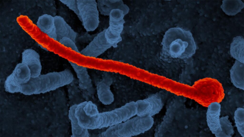 Ein Breitband-Antiviral ist auf 6 tödliche Viren im Labor abzielt