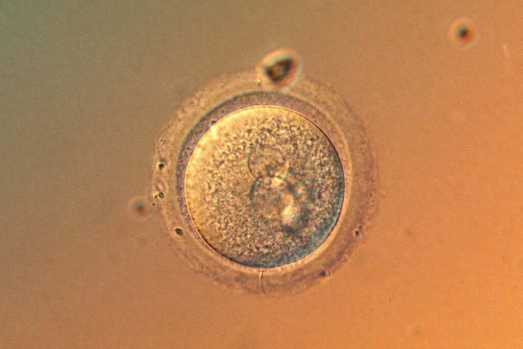 Menschliche Eier sammeln nicht so viele Mutationen mit dem Alter, wie wir dachten Menschliche Eier sammeln nicht so viele Mutationen mit dem Alter, wie wir dachten