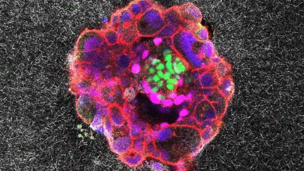 Beobachten Sie selbst ein menschliches Embryo -Implantat - mit brutaler Kraft