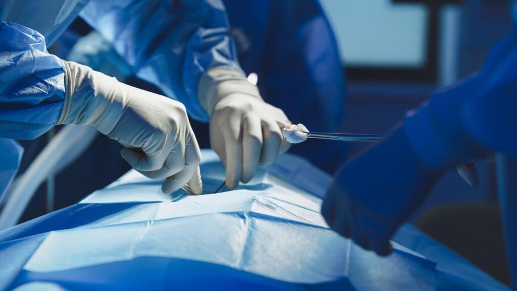 Wissenschaftler führen die erste Lungentransplantation von Pig-to-Human | durch | Das Lungengewebe blieb neun Tage nach der Transplantation trotz früher Anzeichen von Entzündungen neun Tage am Leben
