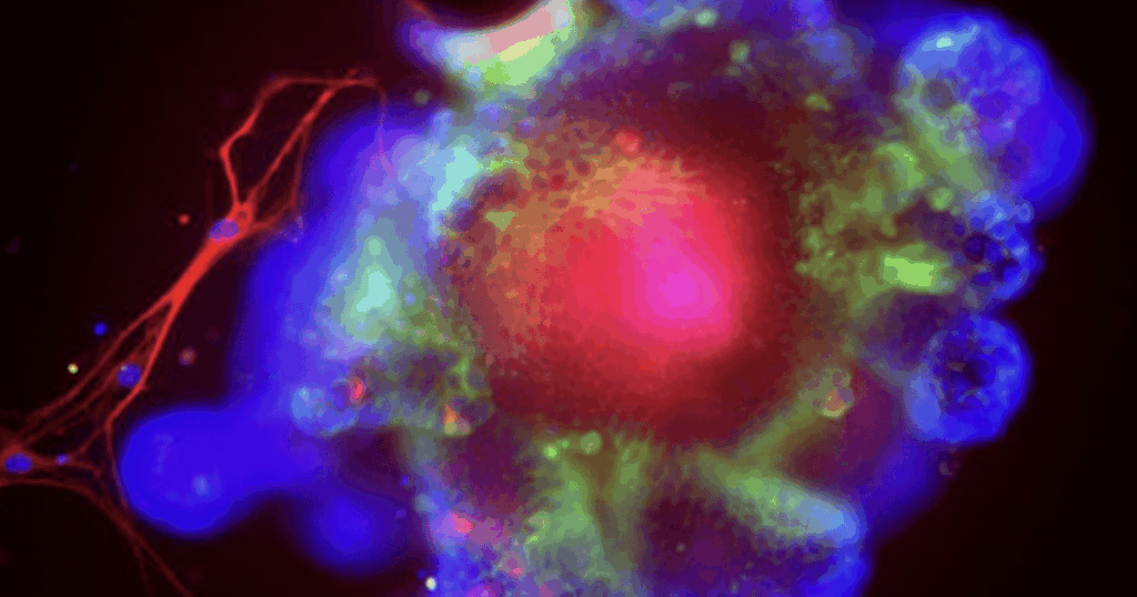 Wissenschaftler haben nun herausgefunden, wie Alkohol im Darm ein immunes „Alarmsystem“ ausschalten kann, sodass schlechte Bakterien ihrem natürlichen Lebensraum entkommen können, um in die Leber zu fluten, was in einer Studie an Mäusen, wie bei alkoholbedingten Lebererkrankungen (ALD), schnell Entzündungen für das Organ verursacht. Wissenschaftler haben nun herausgefunden, wie Alkohol im Darm ein immunes "Alarmsystem" ausschalten kann, sodass schlechte Bakterien ihrem natürlichen Lebensraum entkommen können, um in die Leber zu fluten, was in einer Studie an Mäusen, wie bei alkoholbedingten Lebererkrankungen (ALD), schnell Entzündungen für das Organ verursacht.