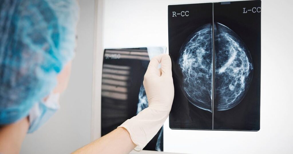 Die Studie zeigt, wie Fettzellen Krebs Tumoren anfeuern können: «Die Ergebnisse können Wissenschaftlern helfen, Wege zu finden, um notorisch aggressive dreifache Brustkrebs zu behandeln. » Die Studie zeigt, wie Fettzellen Krebs Tumoren anfeuern können: «Die Ergebnisse können Wissenschaftlern helfen, Wege zu finden, um notorisch aggressive dreifache Brustkrebs zu behandeln. »