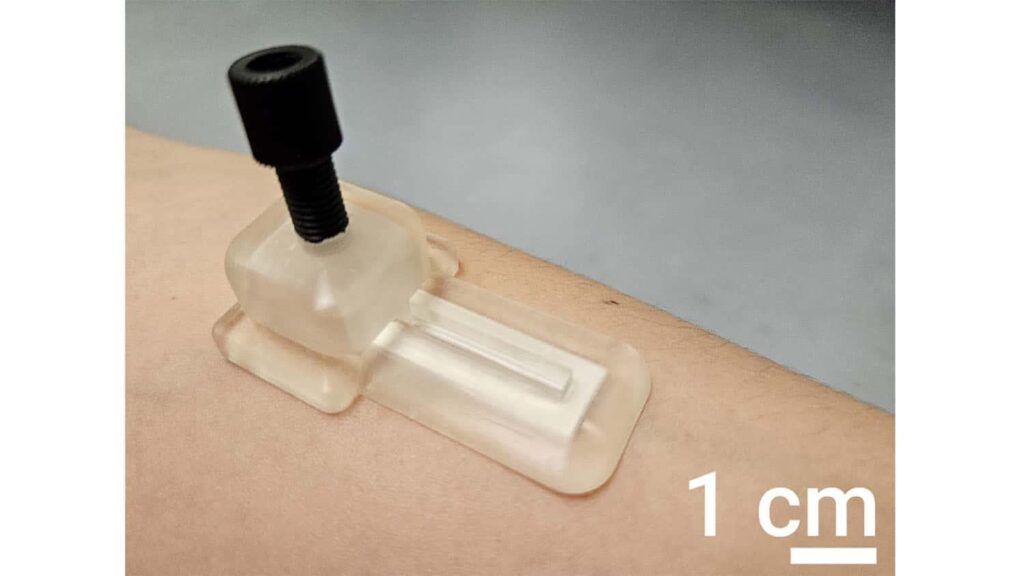 Forscher haben ein selbst betriebenes Mikronedle-Patch entwickelt, um eine Reihe von Gesundheitsbiomarkern zu überwachen, ohne Blut zu ziehen oder sich auf Batterien oder externe Geräte zu verlassen