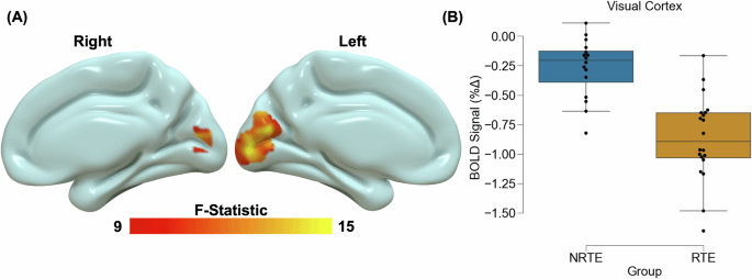 Traumatische Stress verändert die neuronale Reaktivität auf die visuelle Stimulation