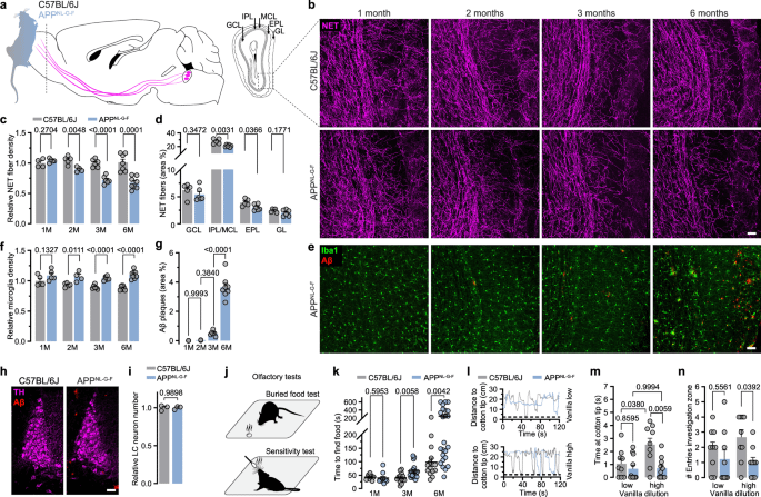 Früher Locus coeruleus Noradrenerge Axonverlust treibt olfaktorische Dysfunktion bei Alzheimer -Krankheit an