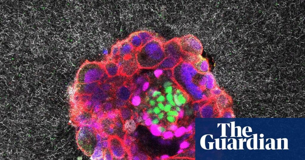 Wissenschaftler erfassen erste Filmmaterial der menschlichen Embryo -Implantation in einer Gebärmutter