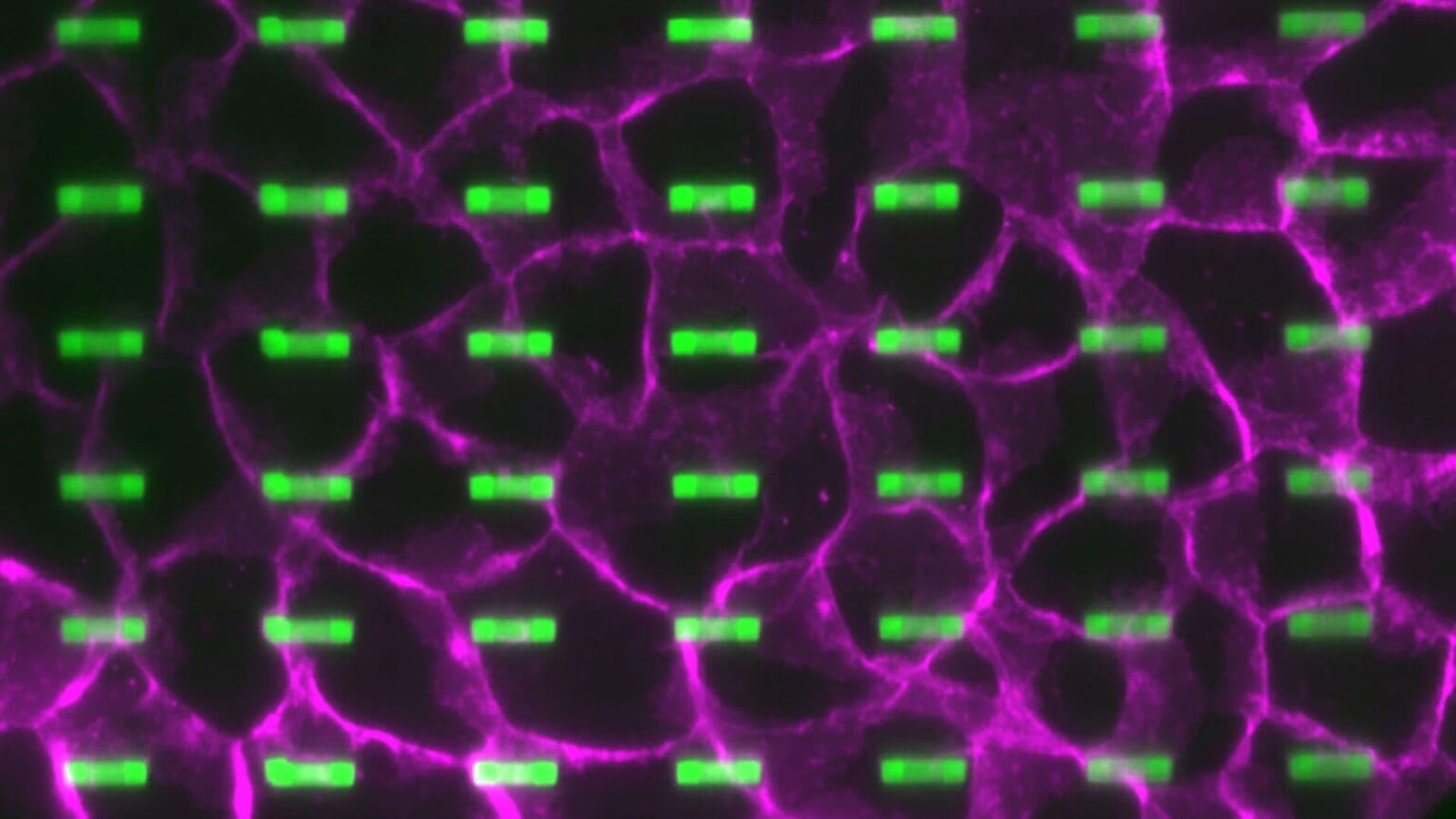 Neue Methode könnte die Art und Weise verbessern, wie Ärzte Medizinprodukte im Weichgewebe implantieren, unter Verwendung der natürlichen Klebstoffeigenschaften des Körpers, um implantierte Materialien an Ort und Stelle zu halten [Advanced Materials]