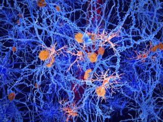 Studie, die Depressionen mit spezifischen veränderten Gehirnzellen verbindet, öffnet die Tür zu neuen Behandlungen