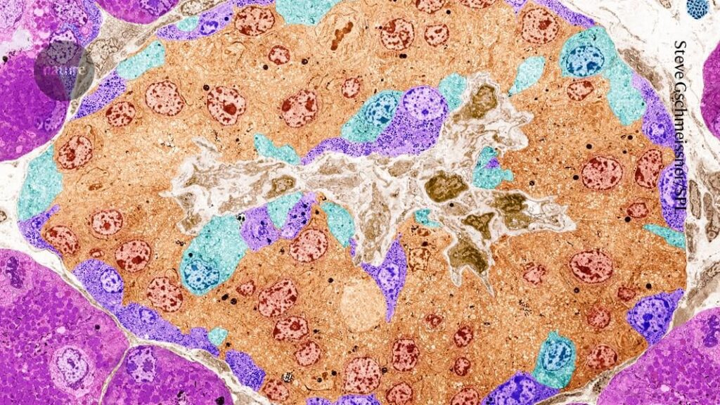 Hoffnung auf Diabetes: CRISPR-bearbeitete Zellen pumpen Insulin in einer Person aus-und entziehen sich im Immunerkennung