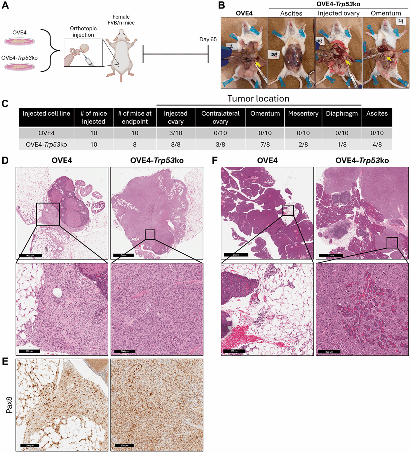 Der Verlust von TRP53 führt zu einem hypoaktiven T-Zell-Phänotyp, begleitet von einer verringerten proinflammatorischen Signalübertragung in einem syngenen orthotopen Mausmodell des serösen Karzinoms des Ovarials hochgradig Der Verlust von TRP53 führt zu einem hypoaktiven T-Zell-Phänotyp, begleitet von einer verringerten proinflammatorischen Signalübertragung in einem syngenen orthotopen Mausmodell des serösen Karzinoms des Ovarials hochgradig