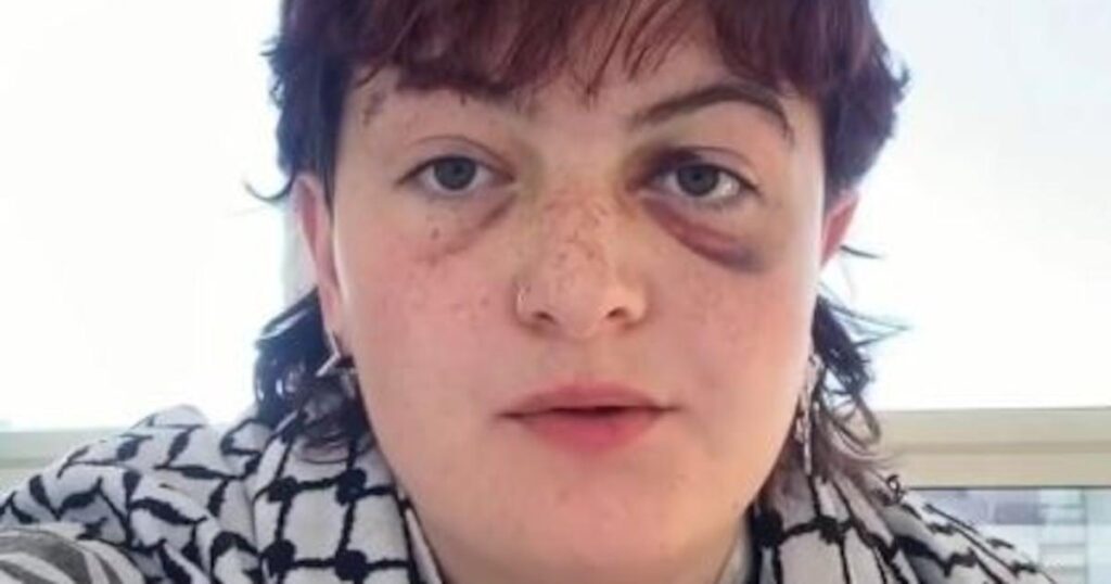 Irish Protestester Kitty O’Brien beschuldigt die Polizei von Berlin der Polizei von weit verbreiteter Gewalt Irish Protestester Kitty O'Brien beschuldigt die Polizei von Berlin der Polizei von weit verbreiteter Gewalt