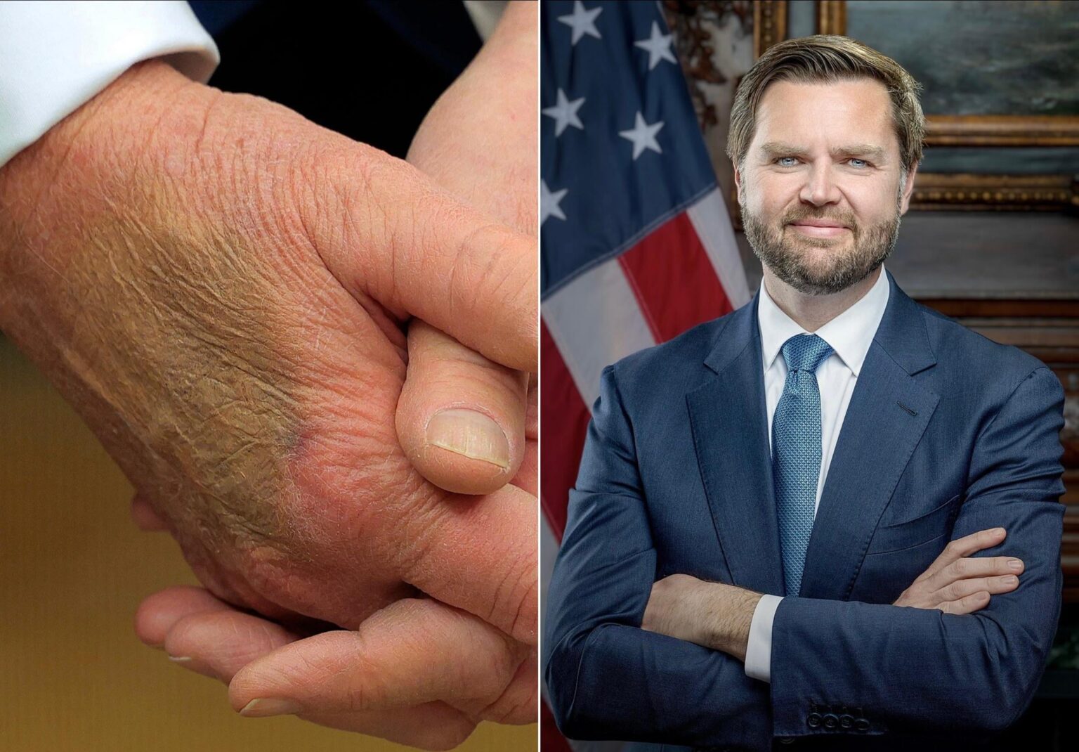 Trump hat in sechs Tagen nicht öffentlich gesprochen, ohne dass Veranstaltungen zum Arbeitstag geplant sind. Es sichtbare Blutergüsse an seiner Hand und JD Vances Kommentar, vorbereitet zu sein, wenn Trump „etwas Schreckliches“ passiert, hat Spekulationen angeheizt. Trump hat in sechs Tagen nicht öffentlich gesprochen, ohne dass Veranstaltungen zum Arbeitstag geplant sind. Es sichtbare Blutergüsse an seiner Hand und JD Vances Kommentar, vorbereitet zu sein, wenn Trump „etwas Schreckliches“ passiert, hat Spekulationen angeheizt.